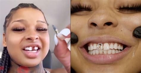 what happened to chrisean rock front tooth|Chrisean Rock Replaces Her Missing Tooth Then。